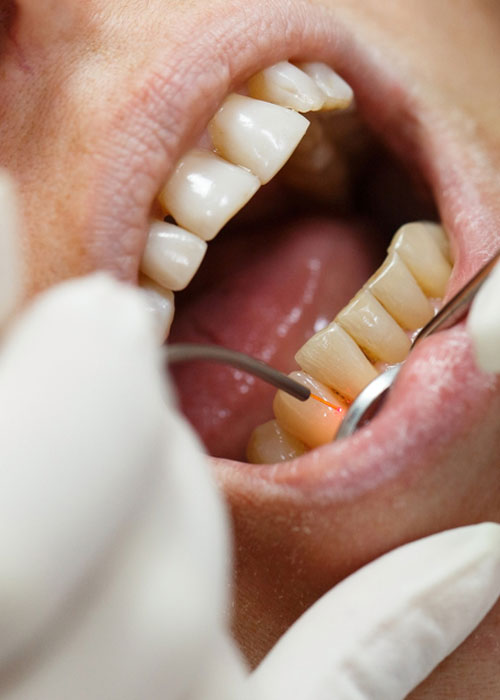 fac---Pioneer-laser--machine